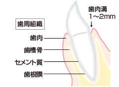 歯周病の進行1